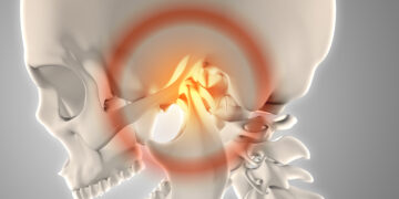 ¿Te duele la mandíbula? Descubre como la fisioterapia puede ayudarte